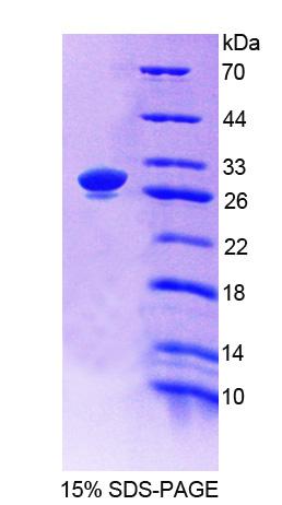 Recombinant Actinin Alpha 1 (ACTN1)