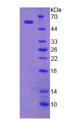 Recombinant Thyroid Hormone Receptor Alpha (THRa)