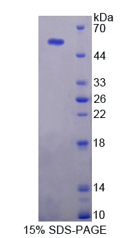 Recombinant Ubiquitin Specific Peptidase 7 (USP7)