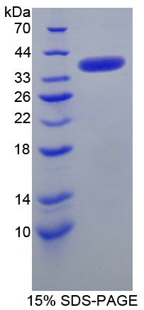 Recombinant Survival Motor Neuron Protein (SMN)