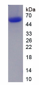 Recombinant Nucleoporin 62 (NUP62)