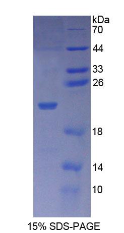 Recombinant Exportin 1 (XPO1)