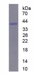 Recombinant Fusion (FUS)