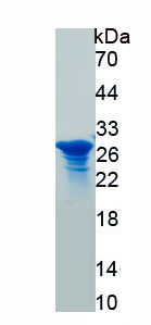 Recombinant Tight Junction Protein 1 (TJP1)