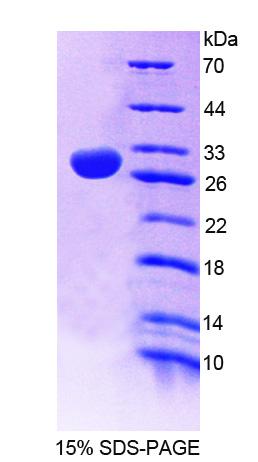 Recombinant 2',3'-Cyclic Nucleotide 3'-Phosphodiesterase (CNP)