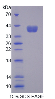 Recombinant Aminoadipate Semialdehyde Phosphopantetheinyl Transferase (AASDHPPT)