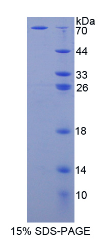 Recombinant Adenosine Kinase (ADK)