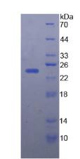 Recombinant Afamin (AFM)