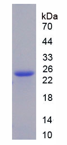 Recombinant Anterior Gradient 2 (AGR2)