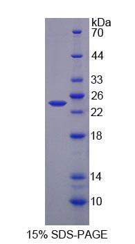 Recombinant Alanine Glyoxylate Aminotransferase (AGXT)