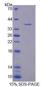 Recombinant Ionized Calcium-binding Adapter Molecule 1 (IBA1)