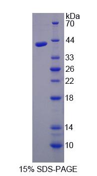 Recombinant Aminolevulinate Delta Dehydratase (ALAD)