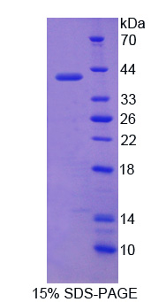 Recombinant Aminolevulinate Delta Dehydratase (ALAD)