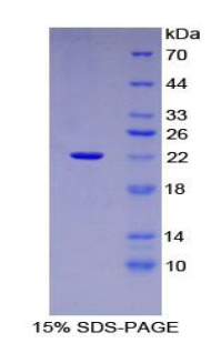 Recombinant Mesencephalic Astrocyte Derived Neurotrophic Factor (MANF)