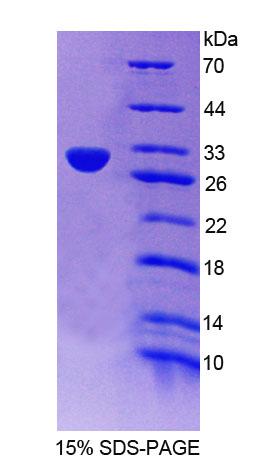 Recombinant Aurora Kinase C (AURKC)