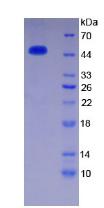 Recombinant Antithrombin (AT)