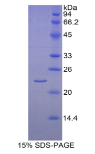 Recombinant Aromatase (ARO)