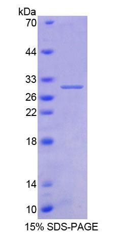 Recombinant Aspartylglucosaminidase (AGA)