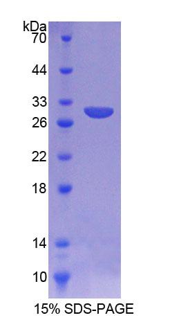 Recombinant Aspartylglucosaminidase (AGA)