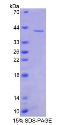 Recombinant Asporin (ASPN)