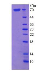 Recombinant Asporin (ASPN)