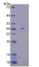 Recombinant Ectonucleotide Pyrophosphatase/Phosphodiesterase 2 (ENPP2)