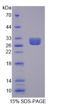 Recombinant Breakpoint Cluster Region (BCR)