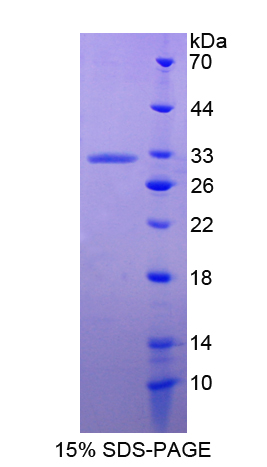 Recombinant Annexin A6 (ANXA6)