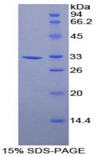 Recombinant Annexin A6 (ANXA6)