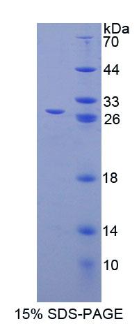 Recombinant Calcium Modulating Ligand (CAMLG)