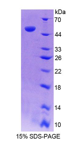 Recombinant Calcium Modulating Ligand (CAMLG)