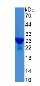 Recombinant Core Binding Factor Beta Subunit (CBFb)