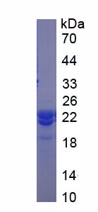 Recombinant Chromobox Homolog 3 (CBX3)