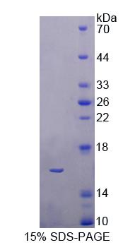 Recombinant Chibby Homolog 1 (CBY1)