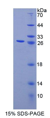 Recombinant Calcium Binding Protein P22 (CHP)