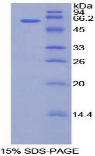 Recombinant Cartilage Intermediate Layer Protein (CILP)