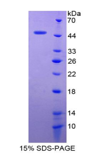 Recombinant Claudin 1 (CLDN1)