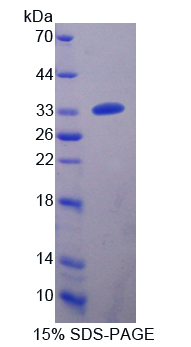 Recombinant Carnitine Acetyltransferase (CRAT)