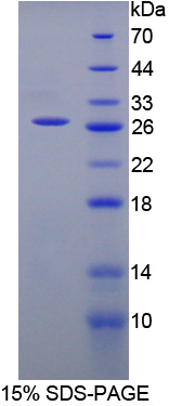 Recombinant Carnitine Acetyltransferase (CRAT)