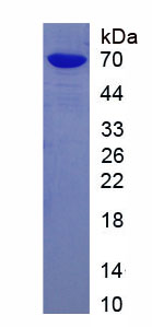 Recombinant Cathepsin E (CTSE)