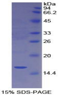 Recombinant Cubilin (CUBN)