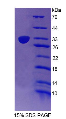 Recombinant Cullin 1 (CUL1)