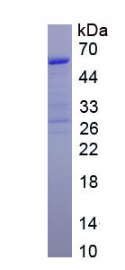 Recombinant Calpastatin (CAST)