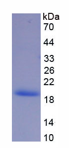 Recombinant Catalase (CAT)