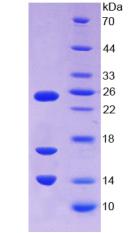 Recombinant Cathelicidin Antimicrobial Peptide (CAMP)