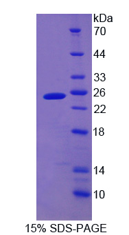 Recombinant Cytoglobin (CYGB)