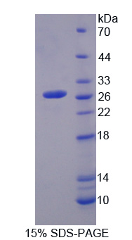 Recombinant Cytoglobin (CYGB)