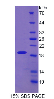 Recombinant Drebrin 1 (DBN1)