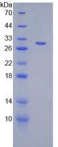 Recombinant Diacylglycerol Kinase Alpha (DGKa)