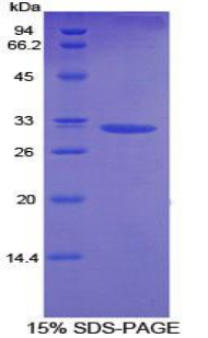 Recombinant Diacylglycerol Kinase Alpha (DGKa)